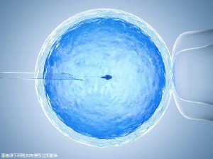 单基因病案例